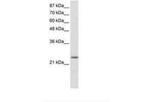 Image no. 1 for anti-MAX Dimerization Protein 3 (MXD3) (AA 40-89) antibody (ABIN202066) (MXD3 antibody  (AA 40-89))