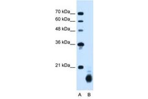 Image no. 2 for anti-Cyclophilin B (PPIB) (C-Term) antibody (ABIN205044) (PPIB antibody  (C-Term))