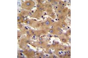 Immunohistochemistry analysis in formalin fixed and paraffin embedded human liver tissue reacted with PHF12 Antibody (C-term) followed which was peroxidase conjugated to the secondary antibody and followed by DAB staining. (PHF12 antibody  (C-Term))