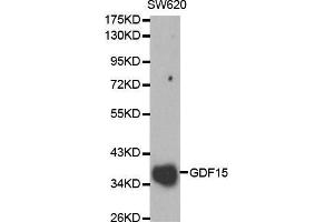 Western blot analysis of SW620 cell lysate using GDF15 antibody. (GDF15 antibody  (AA 49-308))