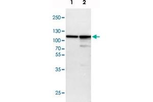 Western blot analysis of Lane 1: NIH-3T3 cell lysate (Mouse embryonic fibroblast cells), Lane 2: NBT-II cell lysate (Rat Wistar bladder tumour cells) with ACTN4 polyclonal antibody  at 1:100-1:500 dilution. (alpha Actinin 4 antibody)