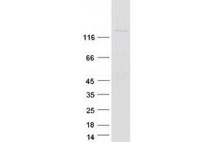 Validation with Western Blot (CD103 Protein (Myc-DYKDDDDK Tag))