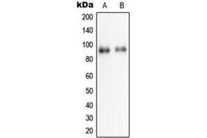 Western blot analysis of NPAS2 expression in HeLa (A), HepG2 (B) whole cell lysates. (NPAS2 antibody  (Center))