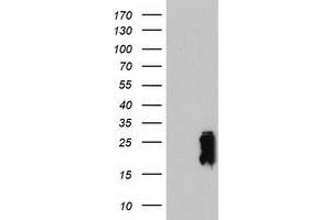 HEK293T cells were transfected with the pCMV6-ENTRY control (Left lane) or pCMV6-ENTRY TAGLN (Right lane) cDNA for 48 hrs and lysed. (Transgelin antibody)