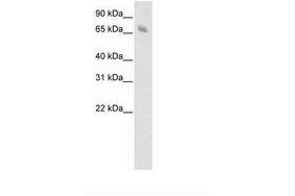 Kelch-like protein 41 (KLHL41) (C-Term) antibody