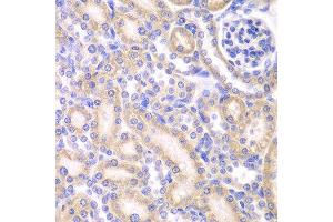 Immunohistochemistry (IHC) image for anti-Adenylate Kinase 4 (AK4) (AA 1-223) antibody (ABIN3022790) (AK4 antibody  (AA 1-223))