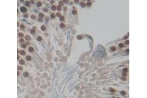#VALUE! (FOXM1 antibody  (AA 209-460))