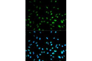 Immunofluorescence analysis of MCF-7 cells using HDAC3 antibody (ABIN5971166). (HDAC3 antibody)