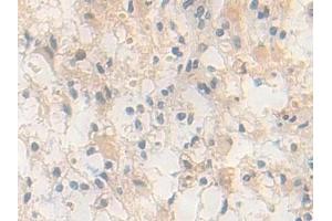 Immunohistochemistry (IHC) image for anti-Pyridoxal Kinase (PDXK) (AA 29-253) antibody (ABIN7440257)