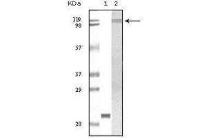 Western Blot showing TYK2 antibody used against truncated TYK2 recombinant protein (1) and Jurkat cell lysate (2). (TYK2 antibody)