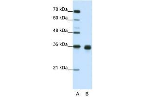 WNT2B antibody used at 1. (WNT2B antibody  (Middle Region))