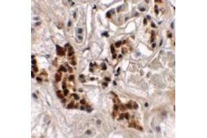 Immunohistochemistry (IHC) image for anti-SPRY Domain Containing 4 (SPRYD4) (Middle Region) antibody (ABIN1031106) (SPRYD4 antibody  (Middle Region))