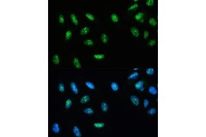 Immunofluorescence analysis of U-2 OS cells using DHX9/RNA Helicase Aantibody (ABIN7265748) at dilution of 1:100. (DHX9 antibody)