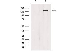 Western blot analysis of extracts from HepG2, using PTPN23 antibody. (PTPN23 antibody  (C-Term))