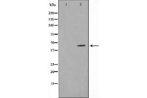 Western blot analysis on HeLa cell lysate using IRF4 Antibody，The lane on the left is treated with the antigen-specific peptide. (IRF4 antibody  (C-Term))