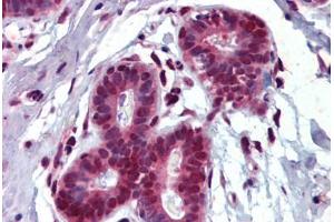 Breast, Human: Formalin-Fixed, Paraffin-Embedded (FFPE) (THRSP antibody)