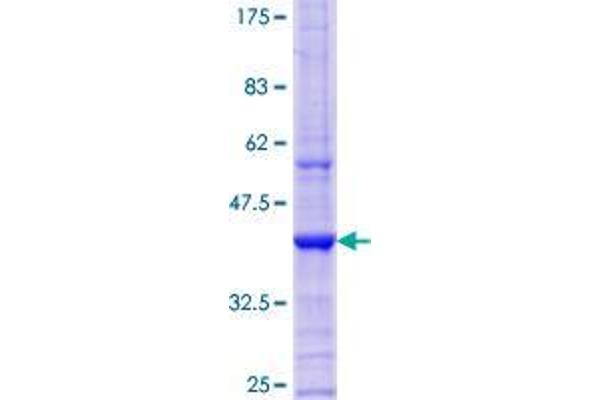 EXOSC3 Protein (AA 176-274) (GST tag)