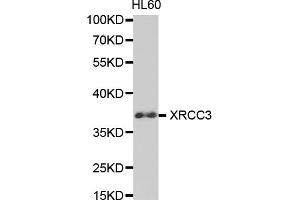 Western blot analysis of extracts of HL-60 cells, using XRCC3 antibody (ABIN5971161) at 1/1000 dilution. (XRCC3 antibody)