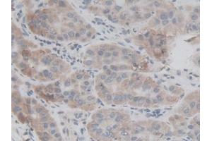 Used in DAB staining on fromalin fixed paraffin- embedded kidney tissue (FAM132A antibody  (AA 92-241))