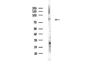 Western blot analysis of lysates from F10-LUC cells(heat-shock,45 min treatment), using M Antibody at 1/1000 dilution.