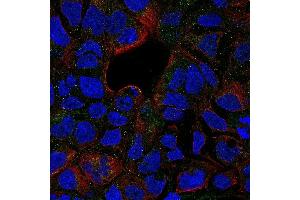 Immunofluorescence (IF) image for anti-Tumor Necrosis Factor Receptor Superfamily, Member 1B (TNFRSF1B) antibody (Biotin) (ABIN2478302) (TNFRSF1B antibody  (Biotin))