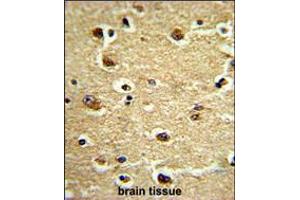 Formalin-fixed and paraffin-embedded human brain tissue reacted with CROT Antibody (N-term), which was peroxidase-conjugated to the secondary antibody, followed by DAB staining. (CROT antibody  (N-Term))