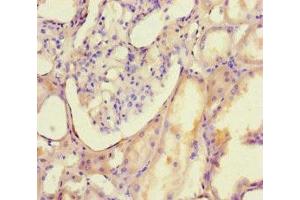 Immunohistochemistry of paraffin-embedded human kidney tissue using ABIN7150116 at dilution of 1:100 (DNMT3B antibody  (AA 1-100))