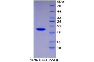 SDS-PAGE analysis of Human Centromere Protein E Protein.