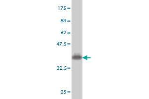 Western Blot detection against Immunogen (36. (COQ8A antibody  (AA 1-100))