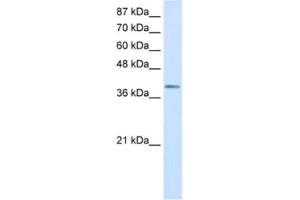 Western Blotting (WB) image for anti-LIM Homeobox Transcription Factor 1, alpha (LMX1A) antibody (ABIN2460347) (LMX1A antibody)