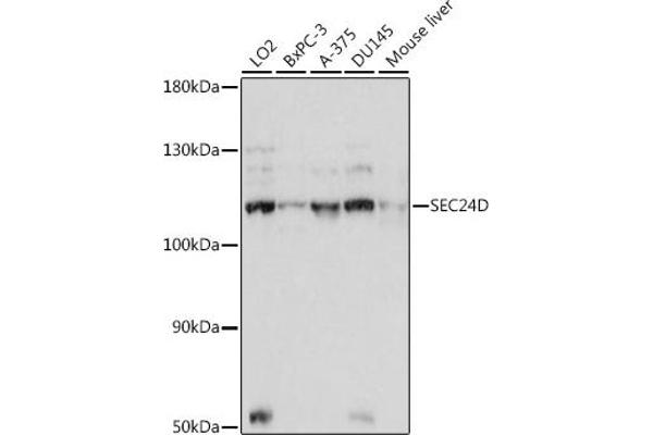 SEC24D Antikörper  (AA 830-1000)