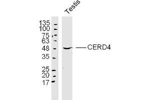Mouse testis lysates probed with CERD4 Polyclonal Antibody, Unconjugated  at 1:300 dilution and 4˚C overnight incubation. (DPF3 antibody  (AA 1-100))