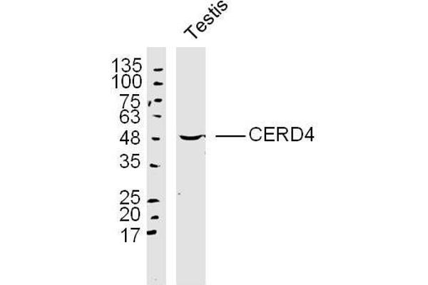 DPF3 anticorps  (AA 1-100)