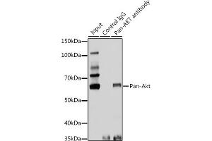 Immunoprecipitation analysis of 25 μg extracts of Rat brain cells using 3 μg Pan-Akt antibody (ABIN7265520). (AKT 1/2/3 antibody)