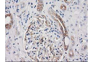 Immunohistochemical staining of paraffin-embedded Human Kidney tissue using anti-CDCP1 mouse monoclonal antibody. (CDCP1 antibody)