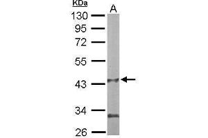 PANK1 antibody