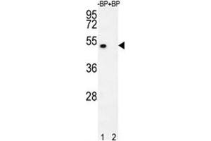Western blot analysis of E2F1 antibody pre-incubated without (lane 1) and with (2) blocking peptide in 293T lysate. (E2F1 antibody  (AA 342-371))