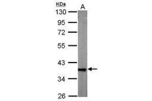 Image no. 2 for anti-Glyceraldehyde-3-Phosphate Dehydrogenase (GAPDH) antibody (ABIN467389) (GAPDH antibody)