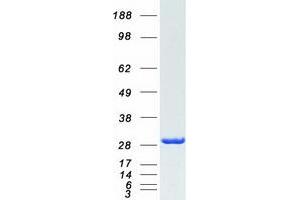 Validation with Western Blot