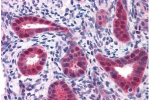 Human Uterus: Formalin-Fixed, Paraffin-Embedded (FFPE) (BUB1B antibody  (AA 274-525))