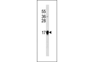 Interferon-alpha western blot analysis in IFN cell line lysates (35 μg/lane). (IFNA antibody)