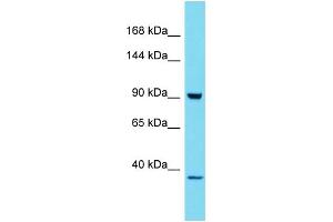Host: Rabbit Target Name: HKDC1 Sample Type: 293T Whole Cell lysates Antibody Dilution: 1. (HKDC1 antibody  (C-Term))