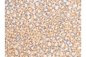 ABIN6267273 at 1/100 staining rat gastric tissue sections by IHC-P.