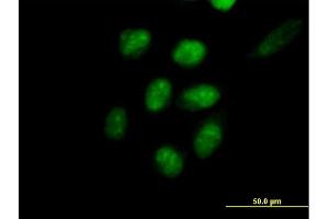 Immunofluorescence of purified MaxPab antibody to EED on HeLa cell. (EED antibody  (AA 1-441))