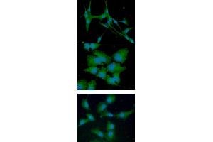ICC/IF analysis of CTSS in U87MG cells line, stained with DAPI (Blue) for nucleus staining and monoclonal anti-human CTSS antibody (1:100) with goat anti-mouse IgG-Alexa fluor 488 conjugate (Green). (Cathepsin S antibody  (AA 17-331))