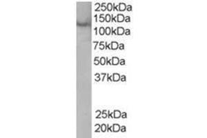Image no. 1 for anti-Zinc Finger, FYVE Domain Containing 20 (ZFYVE20) (C-Term) antibody (ABIN374348) (Rabenosyn 5 antibody  (C-Term))