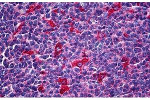 Human Tonsil: Formalin-Fixed, Paraffin-Embedded (FFPE) (ATP6V1A antibody)