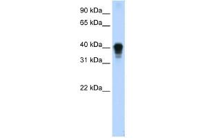 WB Suggested Anti-TIA1 Antibody Titration:  0. (TIA1 antibody  (C-Term))