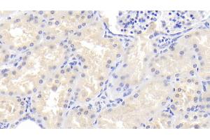 Detection of PDPK1 in Human Kidney Tissue using Polyclonal Antibody to Phosphoinositide Dependent Protein Kinase 1 (PDPK1) (PDPK1 antibody  (AA 83-338))