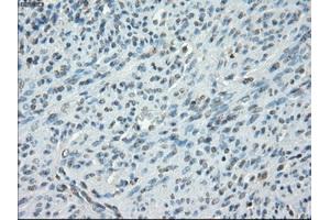 Immunohistochemical staining of paraffin-embedded colon tissue using anti-PRKAR1Amouse monoclonal antibody. (PRKAR1A antibody)